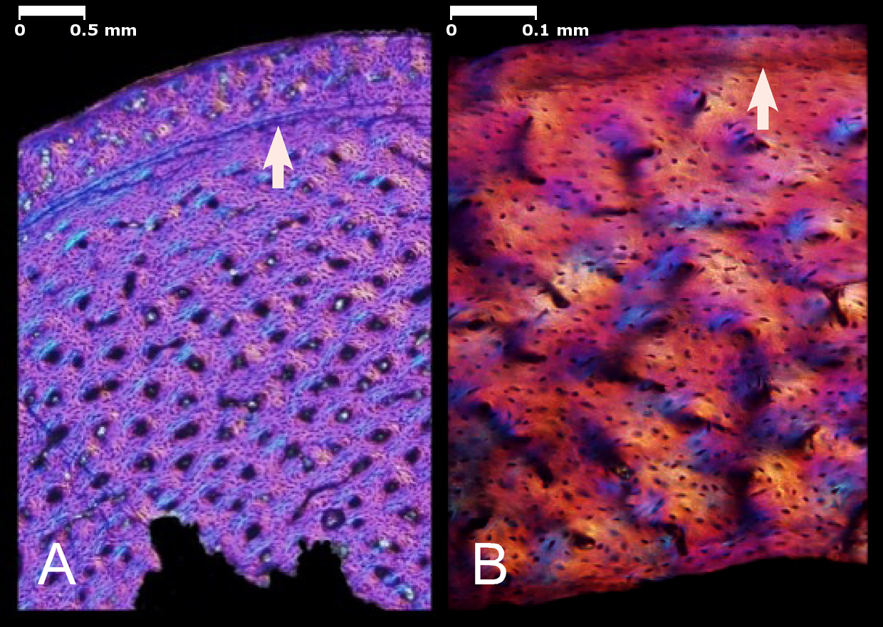 Long bone histology of a non-avialan dinosaur and a Mesozoic bird viewed with polarized microscopy - Creative Commons Attribution 2.5 Generic license. Wikimedia Commons